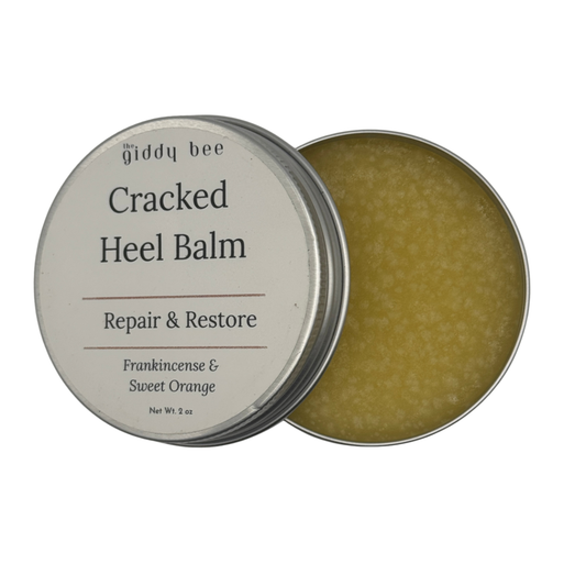 Round tin of cracked heel balm for dry heels